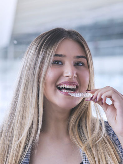 suresmile aligners