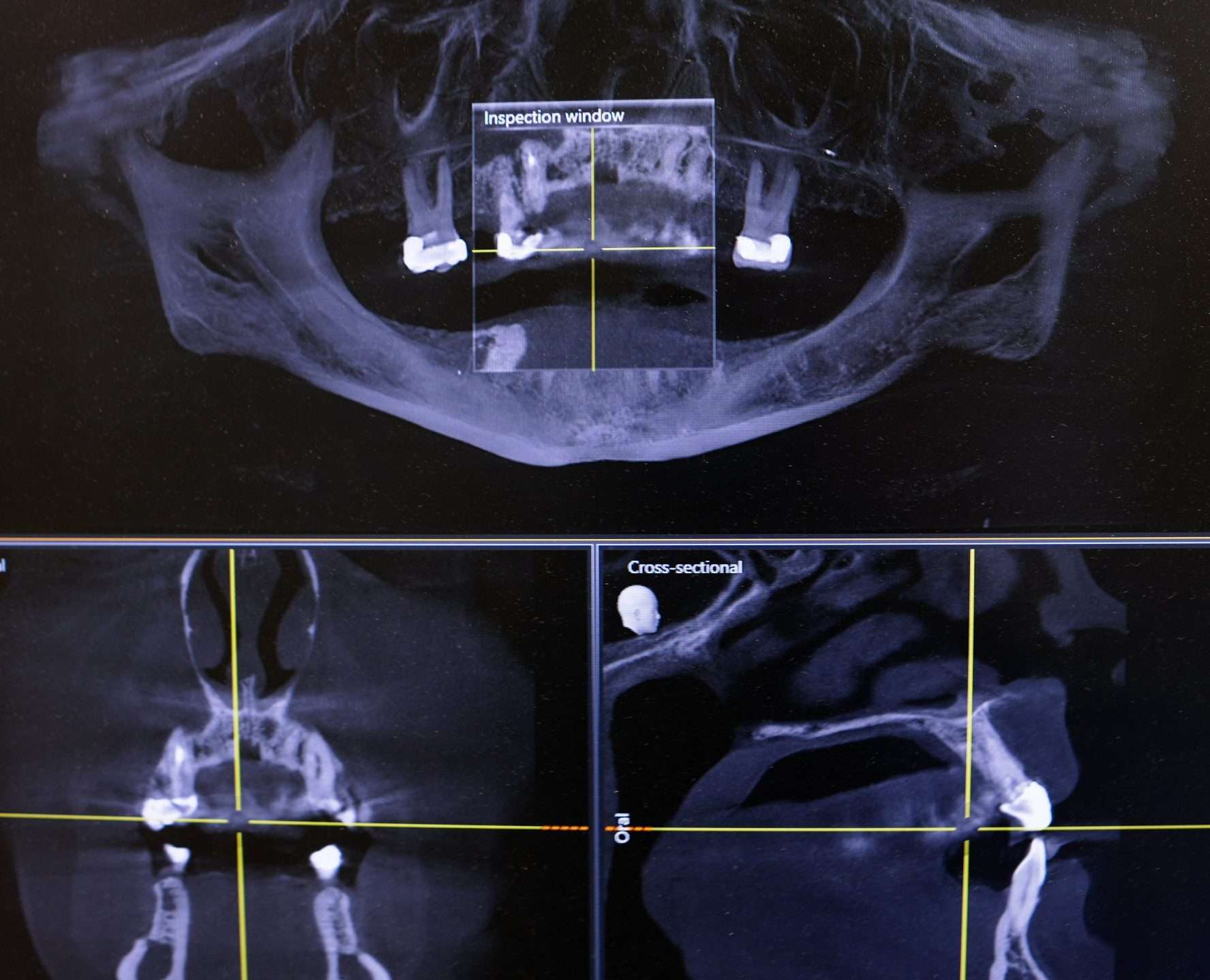 Dental care at DDS Northwest